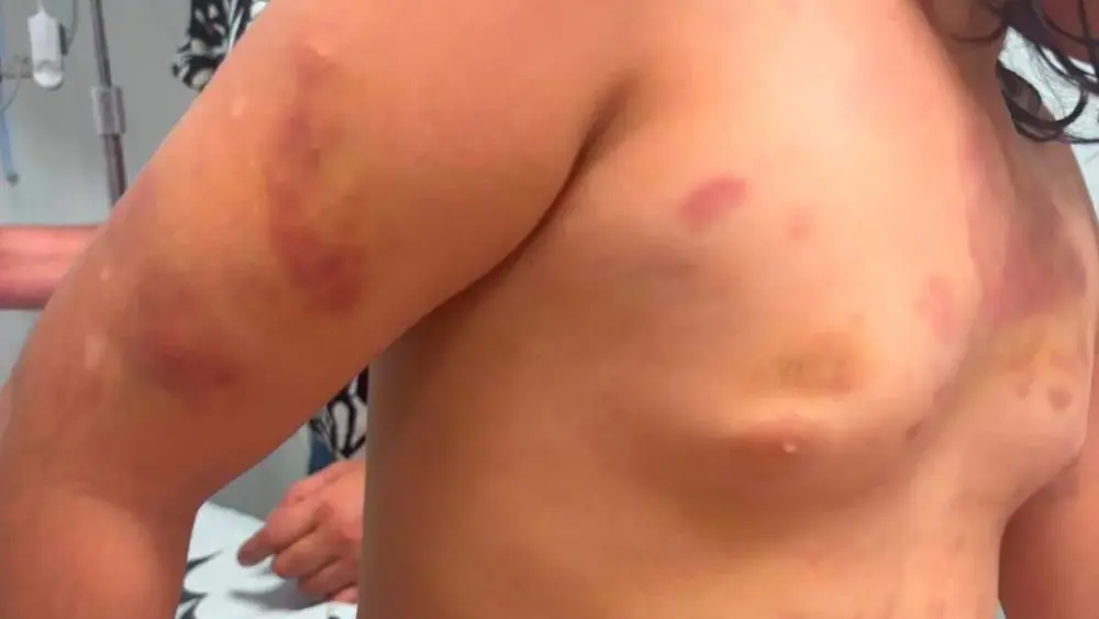 Padrasto preso após agredir menina autista de 6 anos